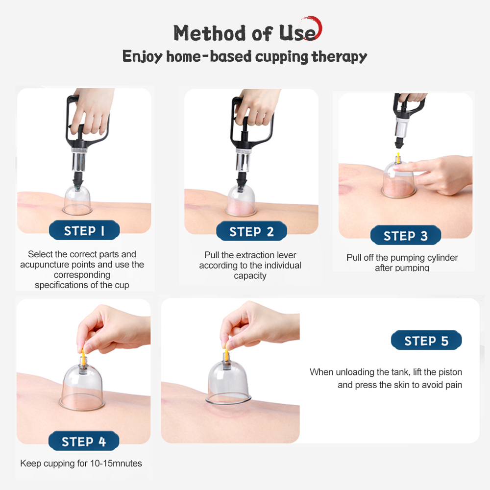 Cofoe-12-24-Cans-Vacuum-Cupping-Machine-Manual-Cupping-Massage-Device-Traditional-Chinese-Medicine-Cupping-Cups-5.jpg