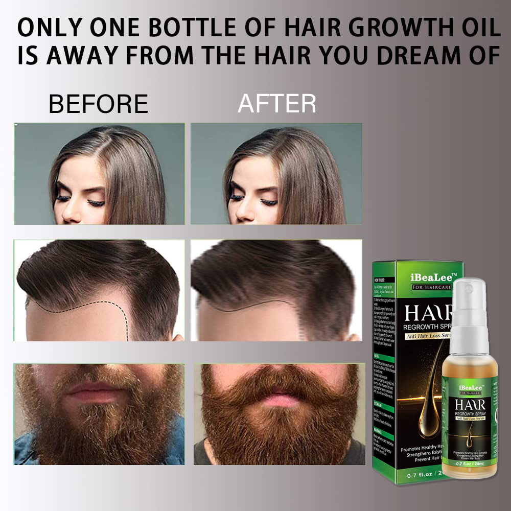 Ginger-Hair-Growth-Products-Fast-Growing-Hair-Essential-Oil-Beauty-Hair-Care-Prevent-Hair-Loss-Oil-1.jpg