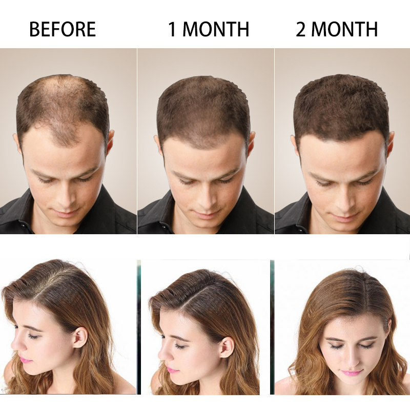 Ginger-Hair-Growth-Products-Fast-Growing-Hair-Essential-Oil-Beauty-Hair-Care-Prevent-Hair-Loss-Oil-2.jpg